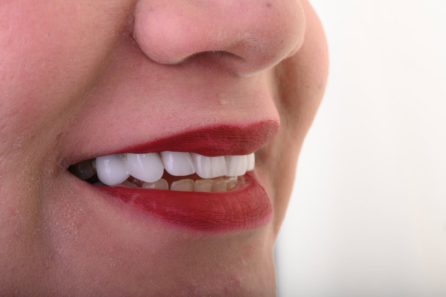 تركيب اسنان 🦷 - د. موسى محمود الكعبي 
📍شارع الاطباء - مركز سومر - الطابق الثاني - مقابل صيدلية موسى مولان 

احجز موعدك الان 📞***********
