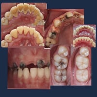 الموصل • علاج أسنان مجاني • كلية طب الاسنان