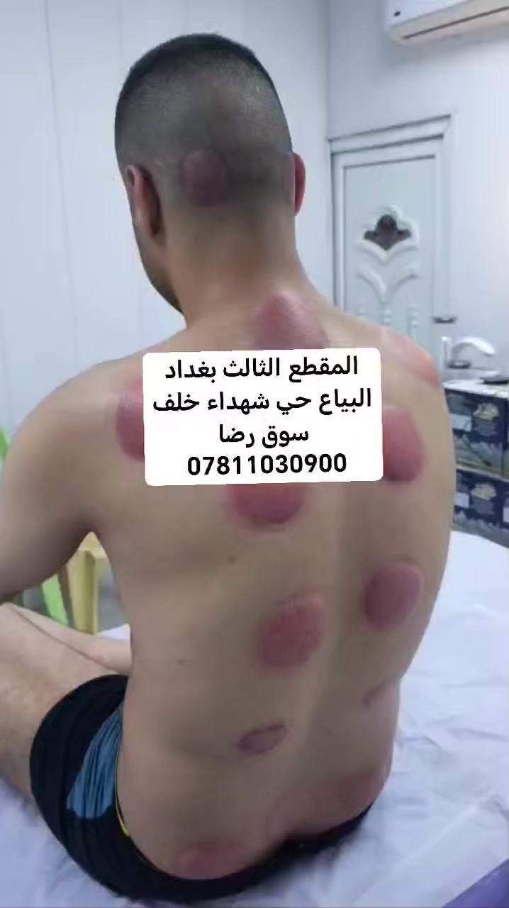 حجامه عنوان بغداد البياع حي شهداء خلف سوق رضا رقم الحجز*********** #العامريه #الكرخ #بغداد #البياع_شارع٢٠ #البياع #البياع_شارع_المضخه #حي_شهداء #حي_الجهااد_الرفاق #البياع_شارع٢٠ #حجامه #صحه_ورشاقة #البياع #البياع_شارع_المضخه #البياع_شارع٢٠ #البياع
