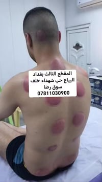 حجامه عنوان بغداد البياع حي شهداء خلف سوق رضا رقم الحجز07811030900 #ال...