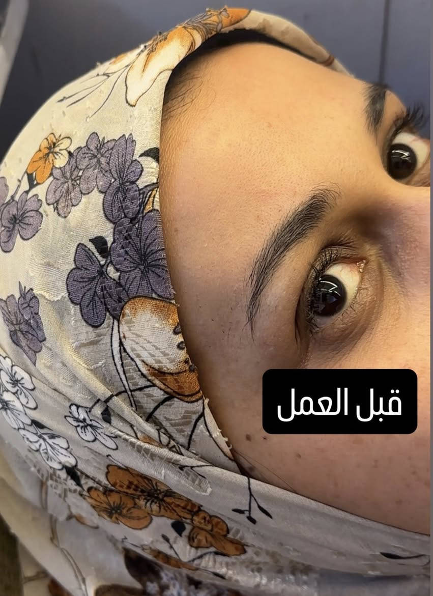 تاتو حواجب بتقنية خاصة بـ باربي و ايضاً الشغل على ذوقي 🫰🏻🥰
لا تنسون العروض مستمرة انسب الاسعار و شغل مضمون يليق بيكم
للاستفسار خاص


**إذا كنت صاحب هذا الإعلان وتريد حذفه لأي سبب، رجاءا أرسل رسالة إلى الدعم الفني**