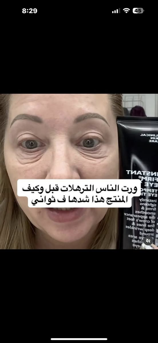 ✨ وصل كريم بيتر توماس روث المعجزة الامريكية لشد البشرة Peter Thomas Roth Instant FirmX Eye هو الحل السريع والفعّال لشدّ منطقة تحت العين والتخلّص من مظهر التعب، التجاعيد، والخطوط الدقيقة خلال دقائق!

هذا المنتج المصمّم بتقنية متطورة يشتغل فورًا على شدّ البشرة وتنعيمها، ويقلّل من مظهر الانتفاخ والهالات، ويخلي منطقة العين تبين أصغر سنًا، أنعم، وأكثر إشراقًا. أول ما تحطّيه، تحسّين بتأثير الشدّ الفوري، وتلاحظين فرق واضح بالملمس والشكل 😍

✨ مميزات المنتج:
شدّ فوري ومؤقّت لمنطقة تحت العين
يقلّل من مظهر التجاعيد والخطوط الدقيقة
يخفف الانتفاخ والهالات
يخلي البشرة ناعمة ومشدودة
مناسب لكل أنواع البشرة
مثالي قبل المكياج أو المناسبات


**إذا كنت صاحب هذا الإعلان وتريد حذفه لأي سبب، رجاءا أرسل رسالة إلى الدعم الفني**