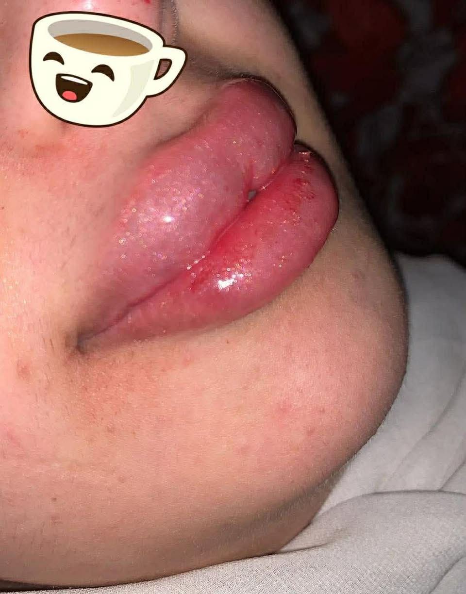 #رمضان_كريم
#اصيل_بيوتي_للتجميل_وليزر

#رؤى_الجبوري

عروضنا لعيونكم الحلووة

كلشي جديد ويفيد الجسم والبشرة متوفر 

عروض على جميع انواع الفلرات والنضارة

وليزر  وليزرنا الحمدلله معروف بنجاح النتاىج❤️

العنوان الجديد

شارع الصالونات بالعماره البيها باور جم مجاور شركة اسيا سيل 

#***********

السنتر مفتوح يوميا من الساعه ال١٢ ظهرا لغايه ١١ مساءا
