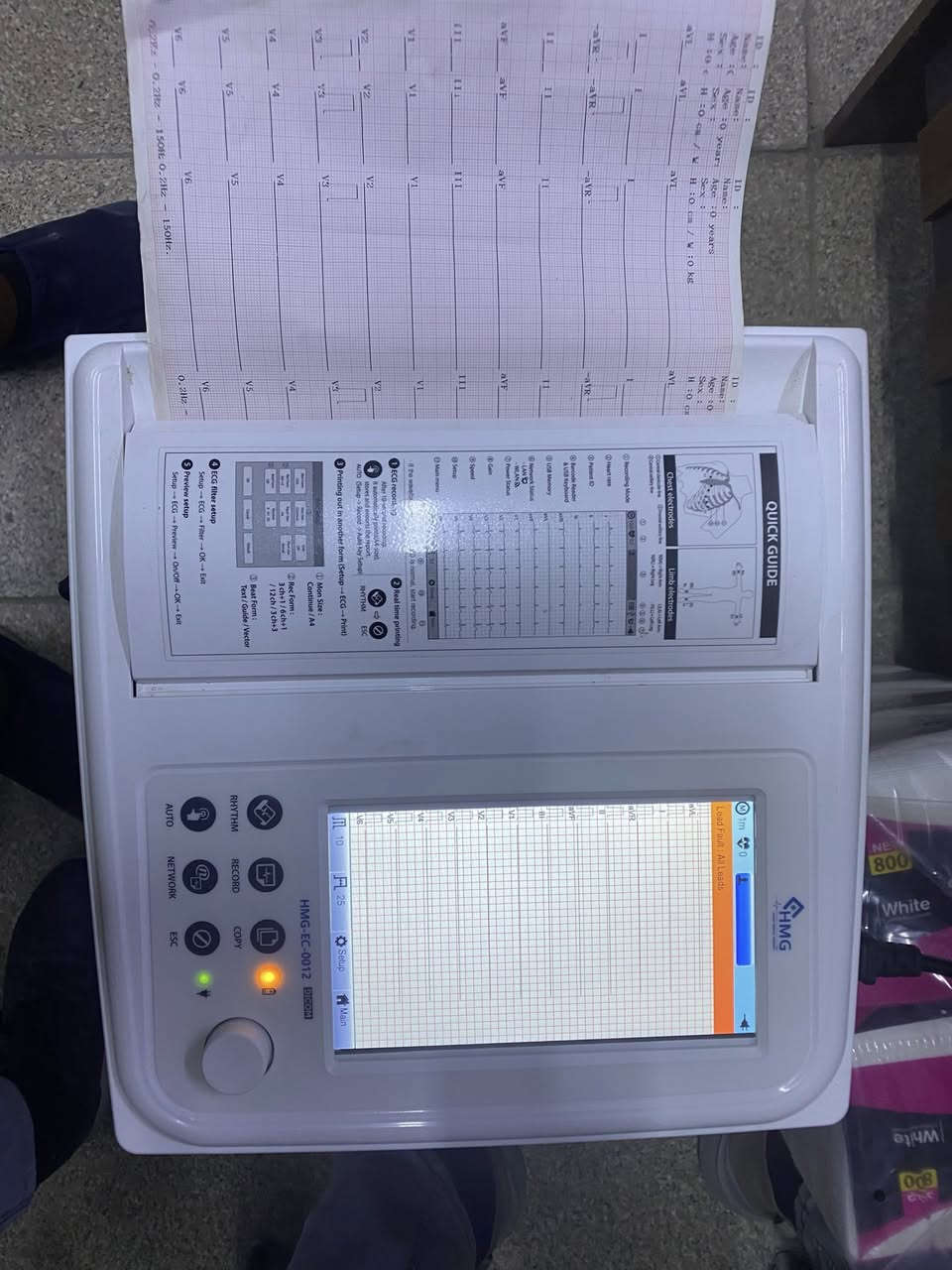 السلام عليكم عندي جهاز تخطيط قلب ١٢ جنل اخو جديد حديث نوع الالماني شركه HMG شاشه لمس رايده ب٧٥٠ الف


**إذا كنت صاحب هذا الإعلان وتريد حذفه لأي سبب، رجاءا أرسل رسالة إلى الدعم الفني**