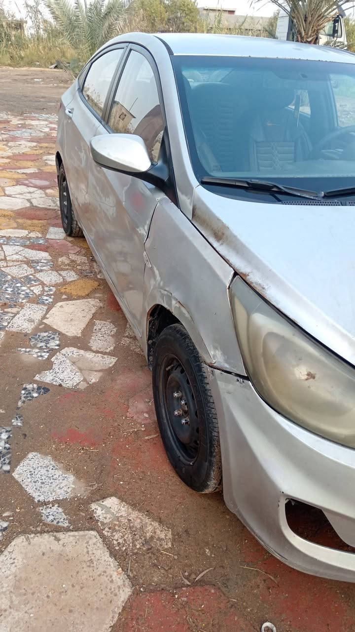 السلام عليكم اكسنت ٢٠١٣ وارد خليجي سعودي أعلا فئه بل اكسنت َمكينه مجفته جديد عبرت ال 750 الله شاهد كير لا صفنه ولا تأخير زوج تاير امامي جديد باتري جديد غرفتها زلغ مابيها حداديه فول تبريد ثلج سنويتها ساقطه صار 3 سنوات وعليها غرامات 400 الف كلها وراك ب 70 وبيها مجال السياره خير من الله والله يرادلها ترتيبات بسيطه بوليش وجلي مازدات ودعاميه اماميه فقط حادثها باب السايق ولوراه ونص الجمالغ الخلفي ابيعلك صفحه بدون تكم ودواخل وبيها دعجه بسيطه بجاملغ الأمامي مثل ما موضح بصوره حجيتلك كل التفاصيل لا تكلي شبيها السياره من تخابرني بيع مستعجل ***********
***********
الكورك بيه واتساب
