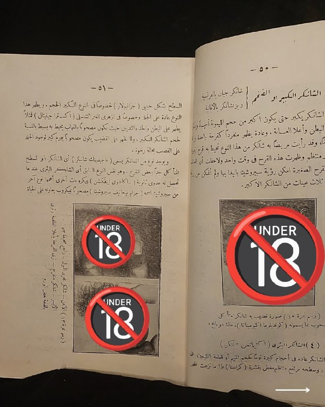 "مرجع طبي تراثي نادر في علم الأمراض السريرية والعلاجات الكلاسيكية!"
🌍
📜
🩺
🩸
📘
(كتاب الأمراض التناسلية وعلاجها وطرق الوقاية منها)
تأليف: الدكتور فخري (طبيب الجلد والأمراض التناسلية).
⚜️
📚
ناشر الطبعة: المطبعة العصرية ومكتبة الخليل لصاحبها خليل الخليلي - مصر
🇪🇬
.
✨
عن هذه النسخة التراثية:
سنة الطبع: 1960-1970
الحالة: ممتازة
✅
الموضوع:
كتاب طبي تاريخي وتخصصي رصين يستعرض بدقة علمية كلاسيكية منظومة الأمراض التناسلية والجلدية الشائعة وطرق تشخيصها السريري وعلاجاتها الدوائية والوقائية المعتمدة في القرن الماضي، يهم جداً أطباء الجلدية والتناسلية، طلاب كليات الطب والصيدلة، الباحثين في تاريخ العلوم الطبية، وهواة اقتناء المخطوطات والمراجع الطبية التراثية النادرة.
للحجز
🔻
:
البوت:
@PH_900bot
أو واتساب: ***********
