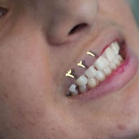حشوه مجانيه • مسابقة • عيادة روح