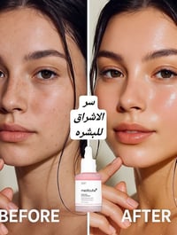 سيروم السلمون • مديكيوب الوردي • ترطيب عميق