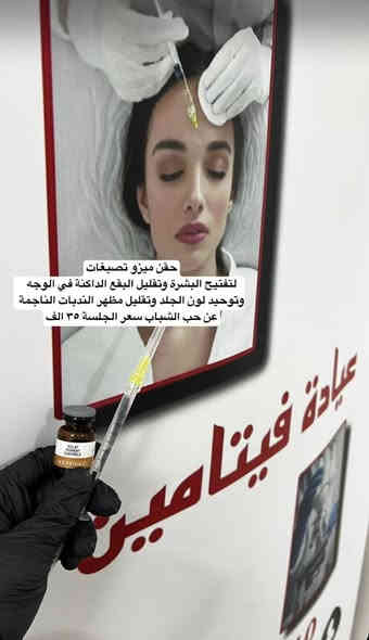عيادة فيتامين للتجميل الغير جراحي
عروض لنهاية السنة فقط

بلازما عادية ٢٥ الف فقط

بلازما مفعلة ٣٥ الف فقط

بلازما ماتركس ٧٥ الف فقط

فلر شفة ١ سيسي ١٠٠ الف فقط

فلر وجنات ٢ سيسي ١٨٠ الف فقط

ابرة نظارة للوجه ٥٠ الف فقط

ابرة العروس ٧٥ الف فقط

ابرة العنبر ٧٥ الف فقط

توريد الشفة ٧٠ الف فقط

بوتوكس ١٠٠ الف فقط

خلايا جذعية للشعر ٧٠ الف فقط

ميزو تصبغات وكلف ٣٥ الف فقط

بايوتين للشعر لعلاج التساقط والفراغات واعادة الحيوية ٥٠ الف فقط

#الحرية شارع ٣٠ قرب اسواق مريومة

للحجز والاستفسار /

*********** اتصال + واتساب

*********** واتساب فقط
