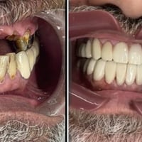 عياده جاكوار للاسنان عنوانه الحارثيه خلف مستشفى الاميرات  (قلع - حشوات...