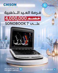 ✨ Chison SonoBook 7 ✨ الآن، وبخصم حقيقي ومباشر يصل إلى 4,000,000 دينار...
