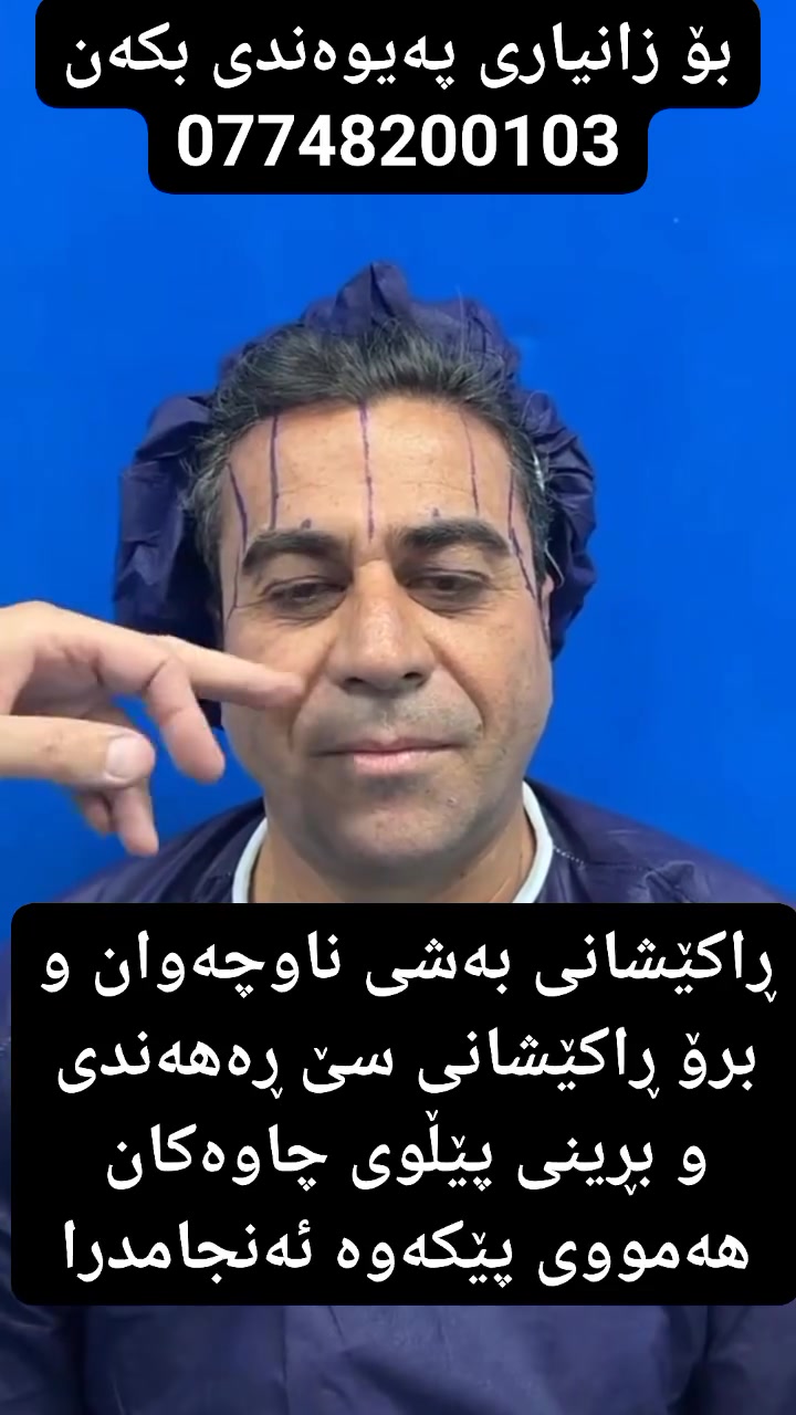 سەنتەری دکتۆرئەمیر ڕەزا سەنتەری جوانکاری درەخشان  بۆ هەموو کارێکی جوانکاری بەباشترین ستافی شارەزاو بە هەرزانترین  نرخ بۆ زانیاری ئەتوانن پەیوەندی بکەن بەم ژمارە تەلەفونەوە یان لە واتس ئاپ یان ڤایبەر 
***********
