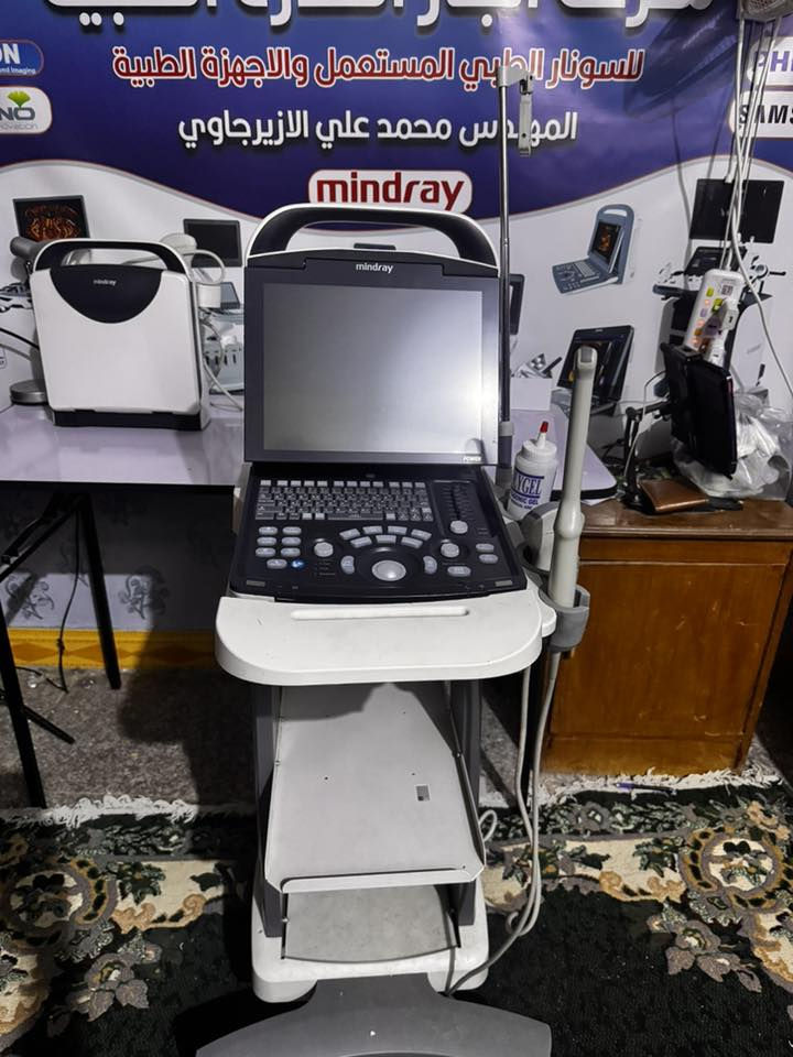 سونار من شركة mindray 
Dp-20 
بعد بالضمان 
السعر جدا مناسب 
بروب مسائي - باطني
بلص ويف 
*********** المهندس محمد علي الازيرجاوي
