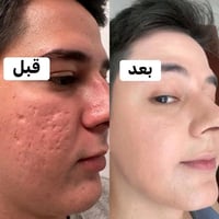 تبيض فوري • مضمونة • ٣ أيام