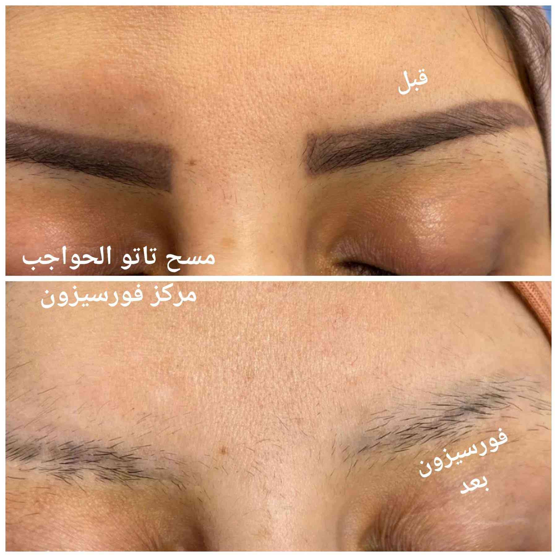 الدلال يمنا وبس ❤️ #عروض العيد ❤خصومات صالون 
فورسيزون  على جميع الاقسام 
_______________________
قسم الشعر  الصبغ والتخصيل خصم 
على كل اصباغ شعر ٣٥٪؜ 
وخصم على تخصيل سليفون ٤٠٪؜

---------------------------
معالج كوكوهير وتسريح خصم عليه ٢٥/:
القص العادي       10  
باقي انواع القص   15 
شسوار                 15 
------------------------------- 
قسم  الشانيلات 
شعر قصير      40 
شعر متوسط   50 
شعر طويل      70 
_______________
قسم التاتو 
تاتو مايكرو.     50  بدل 100
تاتو فابروس    50  بدل 100
تاتو سكس دي 50  بدل 100
تاتو شفه         50  بدل 100 
تاتو لاينر.         50  بدل 100  
جميع انواع التاتو مع تخدير موضعي بدون الم 
_______________
قسم البشره 
حف وجه كامل      10  الف بدل  15
واكس وجه كامل   10 الف بدل   15 
تنظيف بشره عادي 15  الف بدل 25
تنظيف وتقشير      40  الف بدل 75
ديرمابن تبيض ونضاره وايتنكك 60  بدل 75
_____________________
عروض  العيد 💅🏼🔥 

…………………….
للحجز والاستفسار مراسلة الصفحه او الاتصال على ***********
العنوان الكوت شارع الهوره مقابل ازياء لبنان
                                   ومجاور ازياء سيف طيبه
