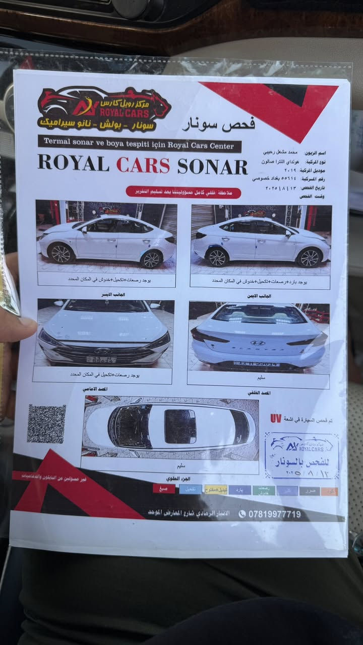 السلام عليكم النترا ٢٠١٩ شكل ٢٠٢٠ خليجي فول مواصفات سياره حلوه مواصفاتها ، بصمة تشغيل ،بصمة ابواب ، فتحة سقف ، شاشة كاربلاي ، مري شفط ، تحكمات ستيرن جهتين ، صندوق ذكي
الاستفسار الاتصال على *********** 
متواجد واتساب ورقم وخاص .
