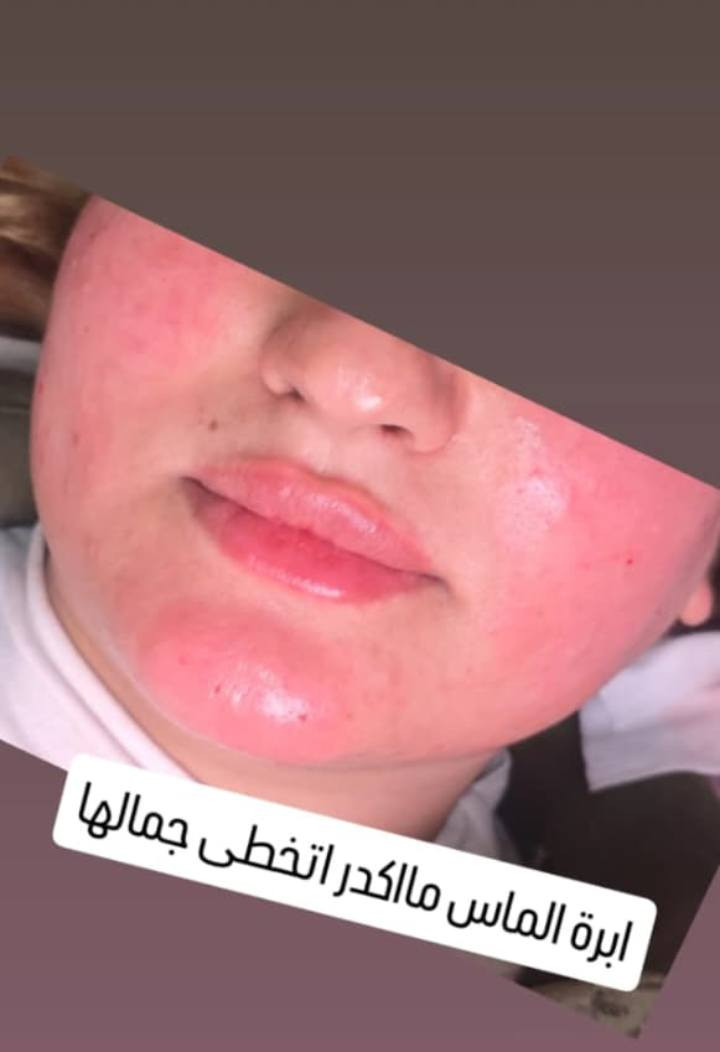 سلام عليكم دكتوره ايرانيه ابو رمانه اسعارهه مناسبه رجال ونساء تشتغل جراحه همين ابو رمانه ***********
