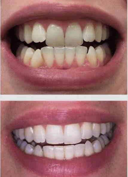 السلام عليكم 
منو محتاج 
قلع 
عيادة اطفال: (قلع ،حشوات ،تنظيف الاسنان) 
تقويم 
حشوات تجميلية ومعدنية
تعويض الاسنان المفقودة بطقم متحرك
فاقد اسنان فك كامل او احدى الفكين 
تنظيف الاسنان من التكلسات
يتواصل وياي 
العمل مجاني بغداد الكراده شارع 52عيادات جامعة ارووك ***********وتساب
