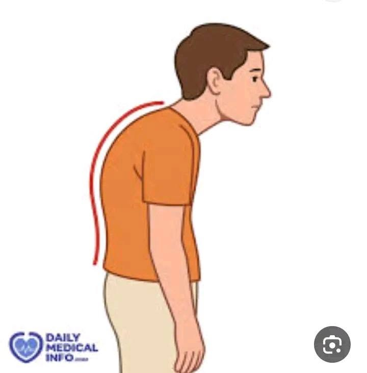 السعر راهو صوووولد اررض✅️✅️ ب 130 الف برك 😎 

" متخليش ضهرك يتعب وإنت في عز شبابك "
" و متستخسرش في روحك 130 الف برك "
""""""" السعر 130 الف فقط  """"""""
✅️يوجد لنساء💗 والرجال 💙
✅ تسحب الكتفين إلى الوراء ويعدل وضعية الضهر
✅ يعطيك وقفة وتقعميزه مستقيمة ومثالية 
✅ يمكن ارتداء تحت الملابس
✅ يعمل على تحسين شكل الجسم في وقت قصير
✅ نسيج مطاطي ، يناسب جميع الأحجام
✅ خامة ممتازة وخياطة متينة  وهدا  يساعد
 على استقامة الظهر و الأكتاف
✅ تخفف الالام
✅ إعطاء وقفة مستقيمه


**إذا كنت صاحب هذا الإعلان وتريد حذفه لأي سبب، رجاءا أرسل رسالة إلى الدعم الفني**