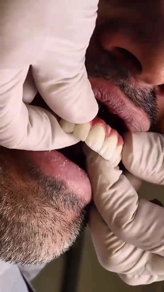 "صحة فمك هي عنوان الثقة والجاذبية."

متواجدين لخدمتكم طيلة أيام الأسبوع #مراكز_الشركة_الطبية_العالمية #صحة_الأسنان #عناية_باللثة 

🔻
🏢 العنوان / بغداد _ الزعفرانية  الاربع شوارع _ مجاور مدرسة الاميرات ..
📲 للحجز والاستفسار 
***********
#مركز_سما_الزعفرانية_لطب_وتجميل_الاسنان
