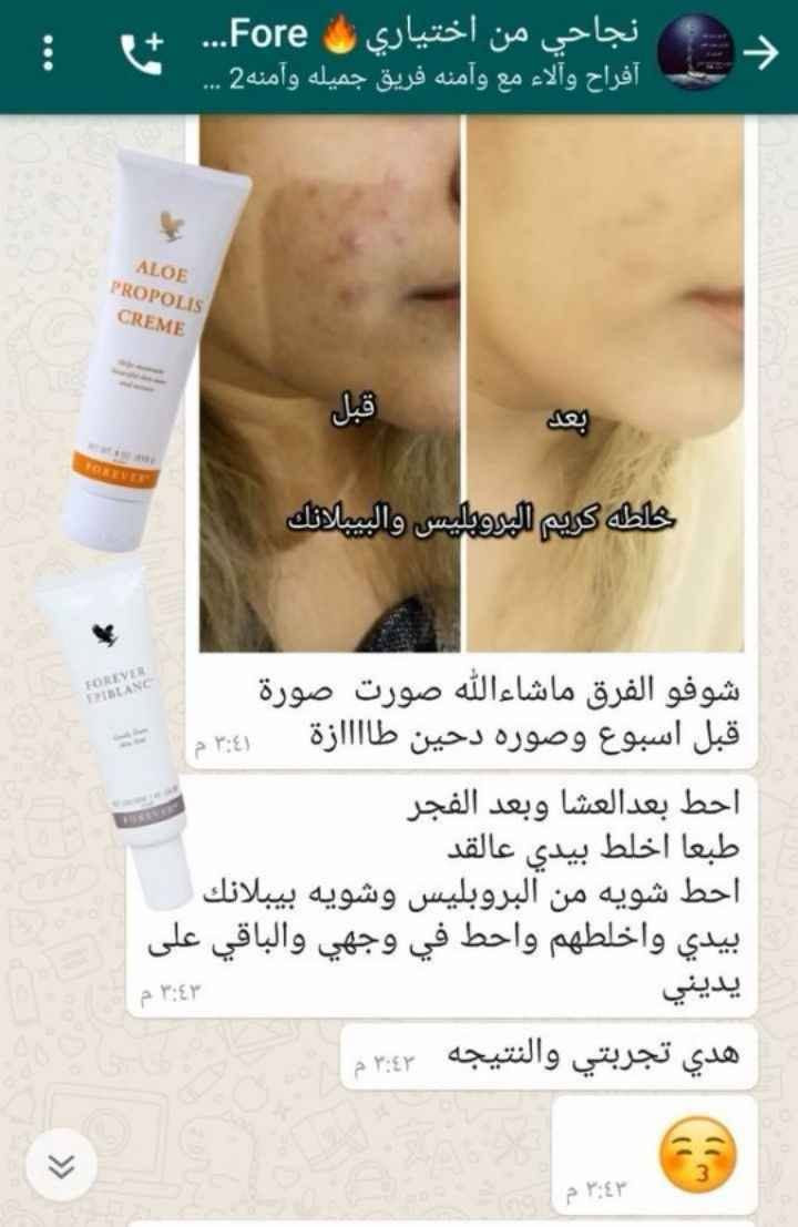 لبشره صافيه ونضره خاليه من الحبوب واثاره والتصبغات 
وفرنالكم صابونه الافكادوا +كريم الوبروبلس لحل جميع مشاكل البشره

سارعو بالحجز الكميات محدوده
منتجات طبيعية ٪
تخلصي من تجاعيد والهالات والكلف والتصبغات وحب الشباب وتخلصي من مشاكل حول العين
للاستفسار راسلي الصفحة
👇🏻👇🏻👇🏻
كل هذ بمنتجين فقط 💪🏻💪🏻 سامراء, صلاح الدين


**إذا كنت صاحب هذا الإعلان وتريد حذفه لأي سبب، رجاءا أرسل رسالة إلى الدعم الفني**