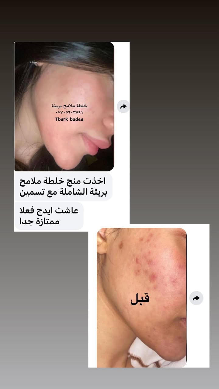 عليها القرأن الي مجربه براندي خلطة ملامح بريئة وفايدها تعلق اهنا بنات يتابعون التعليقات يردون يستخدموهاويستفسرون منكم  👈🌹


**إذا كنت صاحب هذا الإعلان وتريد حذفه لأي سبب، رجاءا أرسل رسالة إلى الدعم الفني**