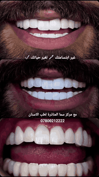 غير ابتسامتك 🪥 تغير حياتك ✔️
مع مركز سما المناذرة التخصصي لطب وجراحة الفم والأسنان 
0780 021 2222
