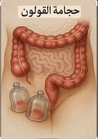 #معلومة مفيدة لمن يعاني من القولون العصبي  تعد الحجامة افضل ما يعالج ب...