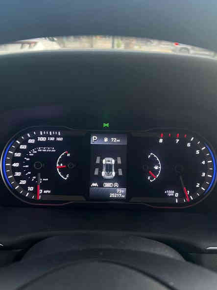 السلام عليكم….. للبيع فقط 
هونداي توكسان 24  دخول جديد رقم اربيل لون إسود مميز نص فول حادث السياره بنيد فقط  بدون ايرباك 

 مواصفات السياره 
 

✅كشنات مخمل  

✅شاشه كبيره 

✅رادار امامي وخلفي 

✅تحكم ستيرن +قياده ذاتيه 

✅ويل كب  

✅مكينه 2500 

✅بدون بصمه 

✅داخل مخمل قماش

السياره ماشيه 25000الف ميل  

وباقي المواصفات المعروفه …. مكان السياره بغداد /الكاظميه 

السعر $184وبيه مجال بسيط 

هـ ***********
