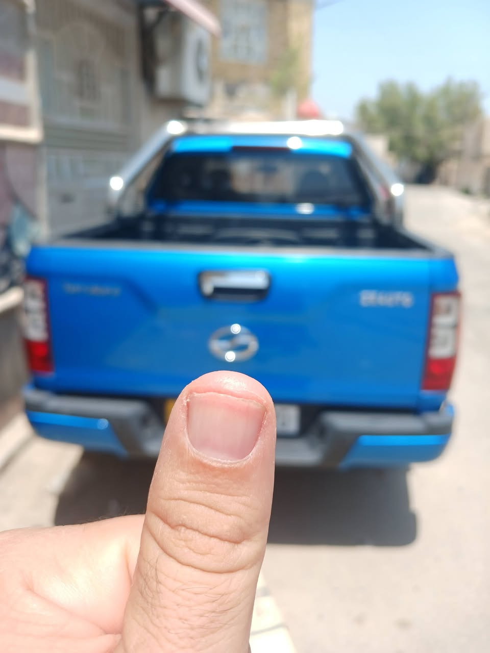 حره مديل ٢٣
سعر ١٢٥ $ رقم بابل


**إذا كنت صاحب هذا الإعلان وتريد حذفه لأي سبب، رجاءا أرسل رسالة إلى الدعم الفني**
