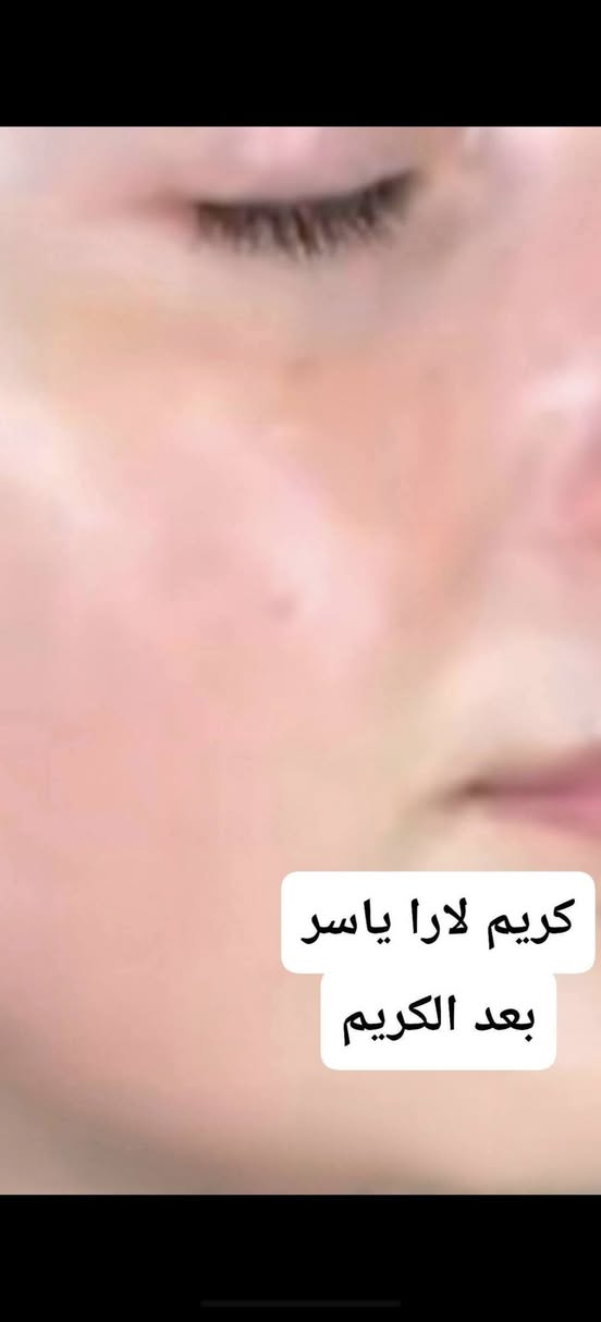 الحمد الله على نتائج كريم لارا ياسر
فديت كيكاتي احبكم 😘😘😘


**إذا كنت صاحب هذا الإعلان وتريد حذفه لأي سبب، رجاءا أرسل رسالة إلى الدعم الفني**