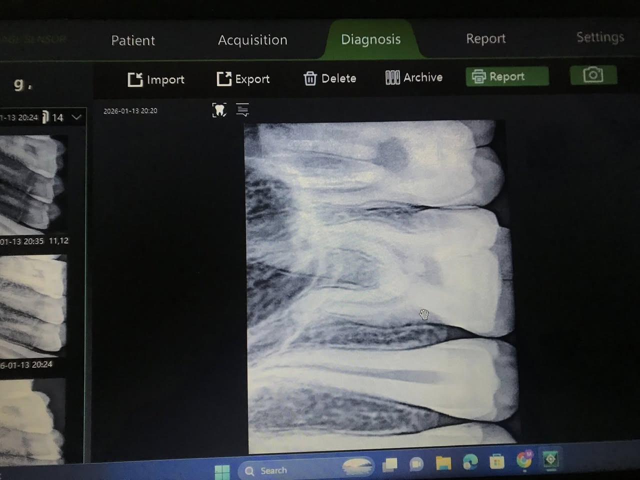 جهاز بورتبل + سنسر اشعه ، جديد فتح على كد التجربه فقط ، السعر خاص


**إذا كنت صاحب هذا الإعلان وتريد حذفه لأي سبب، رجاءا أرسل رسالة إلى الدعم الفني**