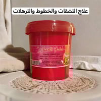 نتيجة اسبوع • علامات التمدد • لكل الألوان