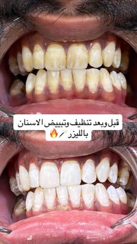 عيادة كنز الابتسامة • نزلة كميره • ٥م-٩م
