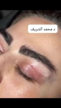 ودّعي ترهلات الجفون!🤝✨🤍🤍🤍🤍🤍 __________________________________________...