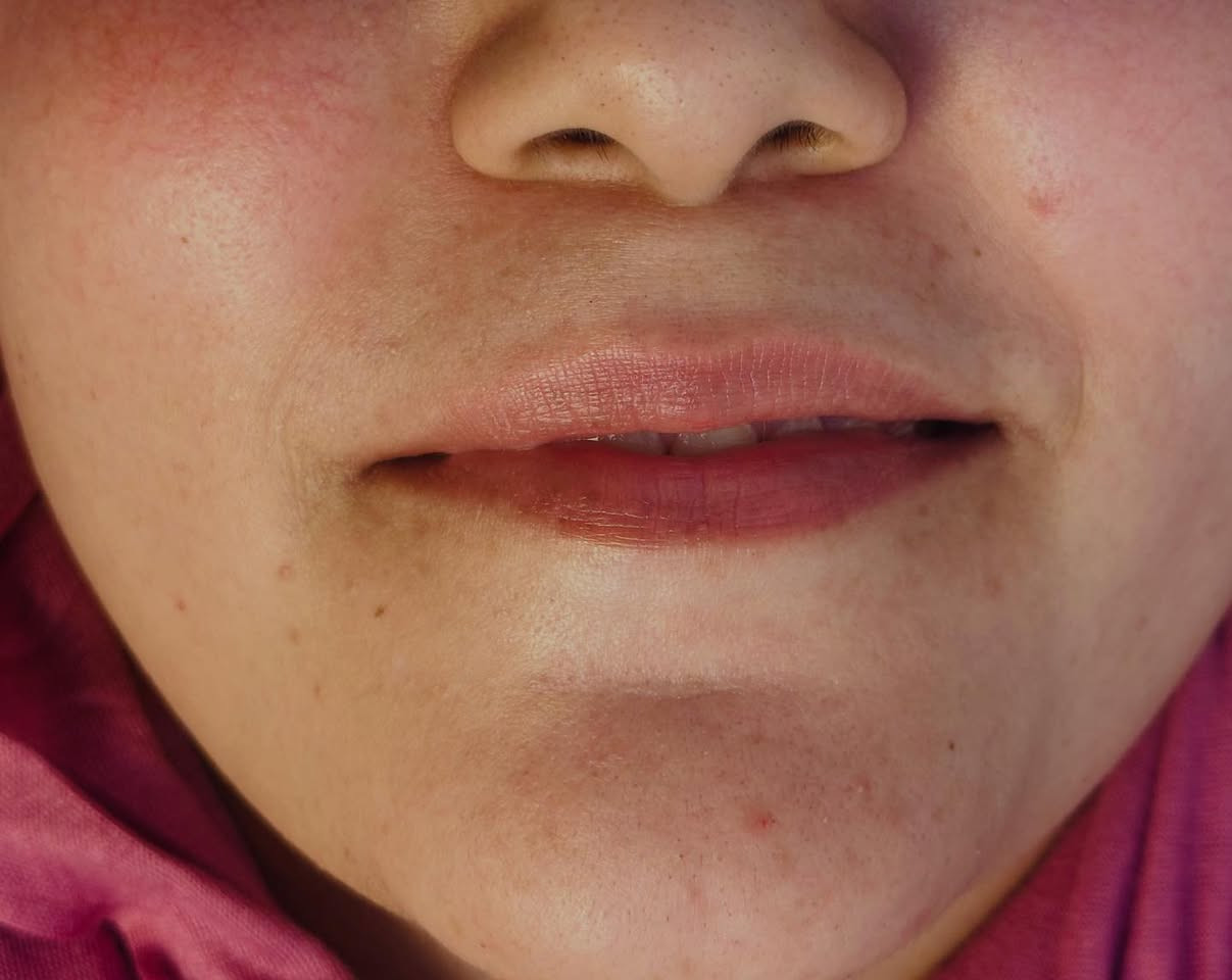 #فيلر


**إذا كنت صاحب هذا الإعلان وتريد حذفه لأي سبب، رجاءا أرسل رسالة إلى الدعم الفني**