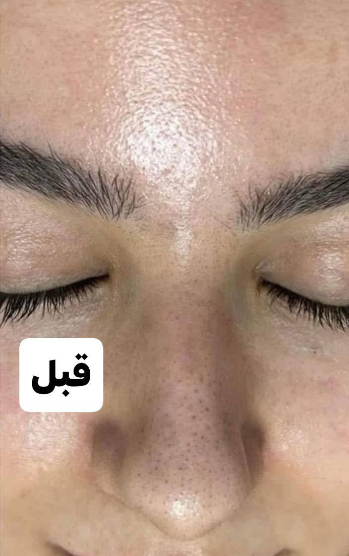 عروض العيد
#عرض_خاص_بأسعار_لاتقبل_المنافسة
#تــاتـوا_بـأحـدث_الأحـبـار_الأمـيـركـيـه_AZ
🔰{ألـ55ـف} تــاتـوا فــايـبـروز
🔰{ألـ55ـف} تــاتـوا مــايـكـروبـلـدنـك
🔰{ألـ45ـف} تــاتـوا 6D
🔰{ألـ35ـف} تــاتـوا بـلــوك
🔰{ألـ35ـف} تــاتـوا تـوريــد شـفــايـف 
🔰{ألـ20ـف} سـحــب لــون  تــاتـوا 
🔰{ألـ20ـف} أزالـة تــاتـوا أطـراف حـاجـب

#قسم_الصالون
🔰️️{ألـ10ـف} قــص شـعـر بأحــدث القــصات 
🔰️️{ألـ5ـف} شســوار شـعـر حســب
🔰️️{ألـ10ـف} معـالـج نانـو للشعـر التالف
🔰️️{ألـ7ف} حــفـافـه وجـه كـامـل مع شمع وسيروم هديه
🔰️️{ألـ15ـف} تركيب رموش طرفيه 
🔰️️{ألـ30ف} تركيب رموش طبيعيه 3D
🔰️️{ألـ30ـف} ميكاب مناسبات فخم مع رموش. مكياج وسط ب20
🔰️️{ألـ30ـف} تسريحات مناسبات. برم اوتسريحه بسيطه ب15

#صـبـغ_الشـعـر_حسب_الطلب
🔰{ألـ15ـف} قصـيـر فــوق الـكــتـف
🔰{ألـ25ـف} قصـيـر حــد الـكــتـف
🔰{ألـ30ـف} قصـيـر تـحــت الـكــتـف
🔰{ألـ35ـف} مـتــوسـط نصـف الظـهـر
🔰{ألـ45ـف} طـويــل نهــايه الظـهـر

#تخصيل_الشـعـر_حسب_الطلب
🔰{ألـ20ـف} قصـيـر فــوق الـكــتـف
🔰{أل35ف} قصـيـر حــد الـكــتـف
🔰{ألـ45ـف} قصـيـر تـحــت الـكــتـف
🔰{ألــ55ف} مـتــوسـط نصـف الظـهـر
🔰{ألـ70ـف} طـويــل نهــايه الظـهـر

#مــسـرح_و_مــعـالـج_و_بروتين_فيرساد
🔰{ألـ40ـف} قصـيـر فــوق الـكــتـف
🔰{ألـ60ـف} قصـيـر حــد الـكــتـف
🔰{ألـ75ـف} قصـيـر تـحــت الـكــتـف
🔰{ألـ100ـف} مـتــوسـط نصـف الظـهـر
🔰{ألـ150ـف} طـويــل نهــايه الظـهـر

#قسم_العنايه_بالبشره
🔰️{ألـ10ـف} خلطه تبيض مناطق حساسه
🔰️{ألـ10ـف} خلطه معالج فوري للكلف
🔰️{ألـ10ـف} خلطه نضاره فائقه للبشره
🔰️{ألـ10ـف} خلطه معالج حب الشباب
🔰️{ألـ10ـف} تـنـظيف بشــره عميق بالماسكات
🔰️️{ألـ10ـف} تـنـظيف بشــره عميق
🔰️️{ألـ20ـف} بي بي كلو عنــايه بالبشــره
🔰️️{ألـ30ـف} ميزوا تبيض فوري للبشره
🔰️️{ألـ30ـف} ميززا معالج فوري للكلف
🔰️️{ألـ30ـف} ميزوا شد و نضاره للبشره
🔰️️{ألـ50ـف} أبرة العروس لنضارة البشره
🔰️️{ألـ5ف}ازاله الشامات السطحيه والزوائد اللحميه

#الـحــجـز_مـســبـق_قـبــل_24_سـاعــه_رجـاءً

🔰نـســتـقـبـل الـزبــائـن الـكــرام
🔰مــن الـســاعـه 🕓  9صـبــاحـاً
🔰الــى الـســاعـه 🕓  12 مـســاءً
عنوان كربلاء حي الوفاء الشارع العام مجاور احمد توفيق للستائر
***********
