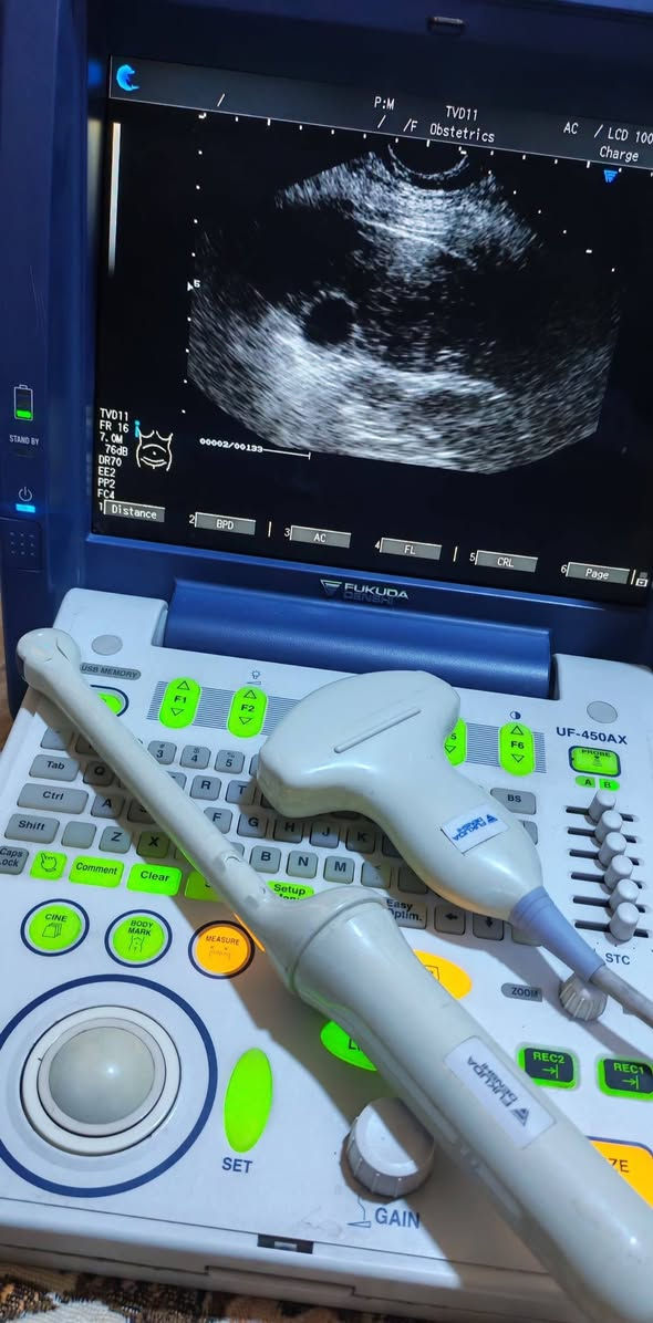 (( جهاز سونار للبيع ))
- جهاز سونار نوع فوكودا Dinshi مستعمل وبسعر مناسب جدا ...
 & اطبائنا الكرام &
- يوجد لدينا جهاز سونار مستعمل :-
اسم الجهاز :  فوكودا Dinshi
سنة الصنع : 2017
المنشا : ياباني
الملحقات : بروبين( كونفكس + فجاينل)  convex + T. V
نوع الجهاز : 2D
مع جميع فحوصات
حالة الجهاز : ممتاز
وضوح الصورة : ممتاز
- للحجز والاستفسار يرجى مراسلة الصفحة او الاتصال على الرقم التالي :-
***********
وبسعر جدا جدا مناسب 💥💥

#أجهزةطبيةمستعملة #أجهزةسونار #سونار #اجهزةطبية #سونارمستعمل #سونارات #سامسونك #اجهزةطبيةجدبدة #اشعة #اشعةوسونار #اطباءسونار #سونرات #مهندس #sonoace #مستلزمات #طبية #فيلد #جل #كونفكس #فجاينل #لينير #4D #ob #gyn #abdomin #ايكو
#adaltecho #exam #GE #volusionp8
