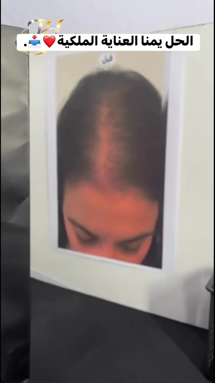 هذا مو سحر هذا التزام على كورس طبيعي للشعر يخلي النتيجه تكون حلوه ومرتبه كل العليكم التواصل خاص للااستفسار🥰❤️


**إذا كنت صاحب هذا الإعلان وتريد حذفه لأي سبب، رجاءا أرسل رسالة إلى الدعم الفني**