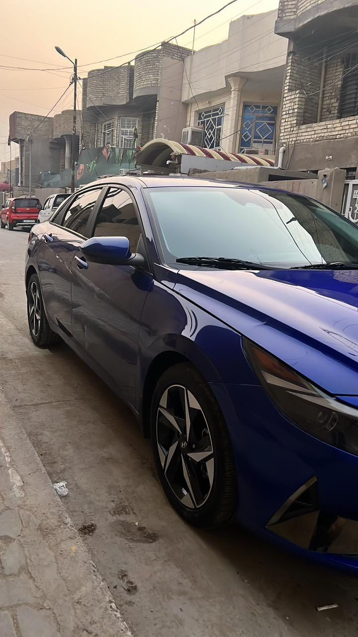 سلام عليكم سياره لبيع النترا امريكي موديل ٢٣ محرك 2000 دوش
السياره كامله بدون اي نقص 

بدون رقم 

 

تبديل قطعه وحده بس لجاملغ وبنيد مصلح 

سياره بصمه 

شاشه متصله 

سياره ماشيه ٢٣ الف 

صور لحادث مرفقه بل المنشور 

السعر ١٤٥

التواصل ***********
