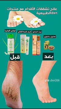 بكج زيارة الأربعين • واقي شمس • تشققات القدم