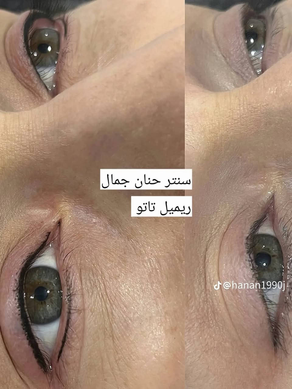 يمنه وبس ندللج دلال تعاي وشوفي العروض السوينهاً ✨
بلوك 25
تاتو مايكرو شعيرات35💃🏻🎉
تشكيل رموش ب20💵💵
تشكيل رموش طرفي ب10🔥
 
مسح اطراف او مقدمة الحواجب 15
توريد شفه تحديد  25🎈🎈
تحديد شفه فقط 15🎉💵💃🏻
اهلا وسهلا بلجميع 💃🏻💃🏻

العنوان//كربلاء قنطرة السلام 
الحجز //777 866 6533

