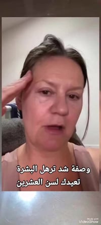 سيرم كولاجين • شد ترهلات • بشرة مشدودة