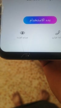 نوفا 5 تي • ١٢٨ جيجا • بطارية ضعيفة