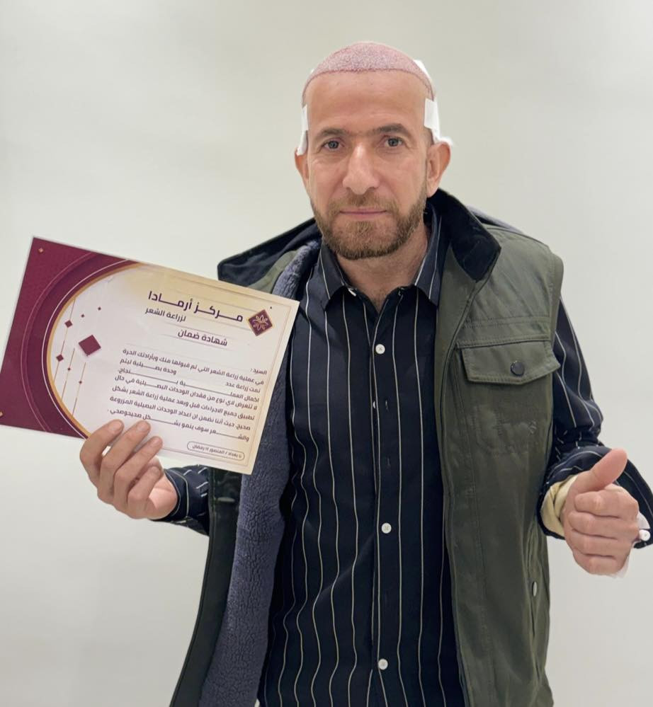 🔥🔥عرض العيد🔥🔥
     
🦋اكيد الكثافه يمنا وبس 🦋

🔥اخلص من مشاكل الشعر وانسى الصلع ويانا 🔥
✨زراعة الشعر بتقنية الـ 3D و6Dوبنفس اتجاه الشعر الطبيعي 
       🔥بتغطية كامله للصلع بجلسة واحده فقط 🙂💯
🔥ورسمه تكون حسب اختيارك وطلبك🧚‍♀️
‌‎ 🔥قطف بإعداد مفتوحه من البصيلات (دون تشوه و اثار بالمنطقه المانحه)
 🔥فتح قنوات بتقنية السفير استخذام فعلي وليس اعلان
 🔥تتم العمليه ع ايادي اطباء مختصين🦋

☄️فقط في مركز ارمادا التخصصي للزراعة الشعر ☄️

‏🌪{𝑉𝐼𝑃 𝑆𝑃𝐸𝐶𝐼𝐴𝐿}🌪العرض الذهبي 750 الف 🔥  

✨10جلسات بلازما ايطالي المنشأ مجاناً💥
✨10 ميزو ثيرابي اسباني المنشأ مجاناً 💥
✨جلستين نضاره للبشره مجاناً💥
✨حقيبه علاجيه متكامله💥
✨وجبة طعام للمريض 💥
✨يشمل العرض كل التحاليل والفحوصات💥
✨تخدير موضعي بجهاز الكومفورت دون الم 
✨العناية بشعر وغسلة لمدة 12 يوم💥
✨شهادة ضمان مدى الحياة💥
✨العناية بشعر المزروع لمدة سنه💥

️ ️️~يتوفر نظام الاقساط 🕊️
      ~القسط الشهري بدون مقدمه 🌪️
~لحاملي بطاقة الماستر كارد الرافدين حصرآ🪐

🦋العنوان :- المنصور ١٤ رمضان  
🦋للحجز و الاستفسار :-الاتصال ع الارقام التاليه

***********
