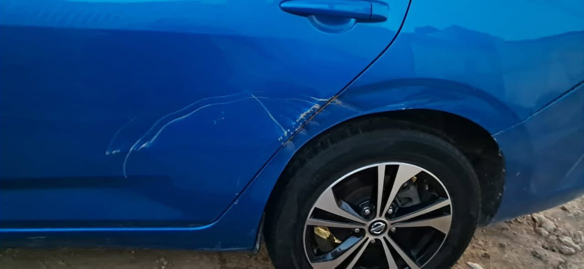 السلام عليكم نيسان ستنرا موديل 2023 وارد أمريكي دخول بدون حادث وصار بيه طخات 3 موضحات في الصوره  رقم بابل معوقين سعر 144 وبيها مجال لاتصال ***********  اتصل وتدلل بدون صبغ كفاله عامه
