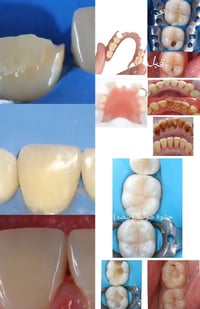 ✨ عروض مميزة في عيادتنا للأسنان ✨ _حشوات لاسنان اماميه وخلفيه سعر5الف ...