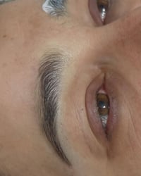 مايكروبليدنك • فيبروز • المدحتية