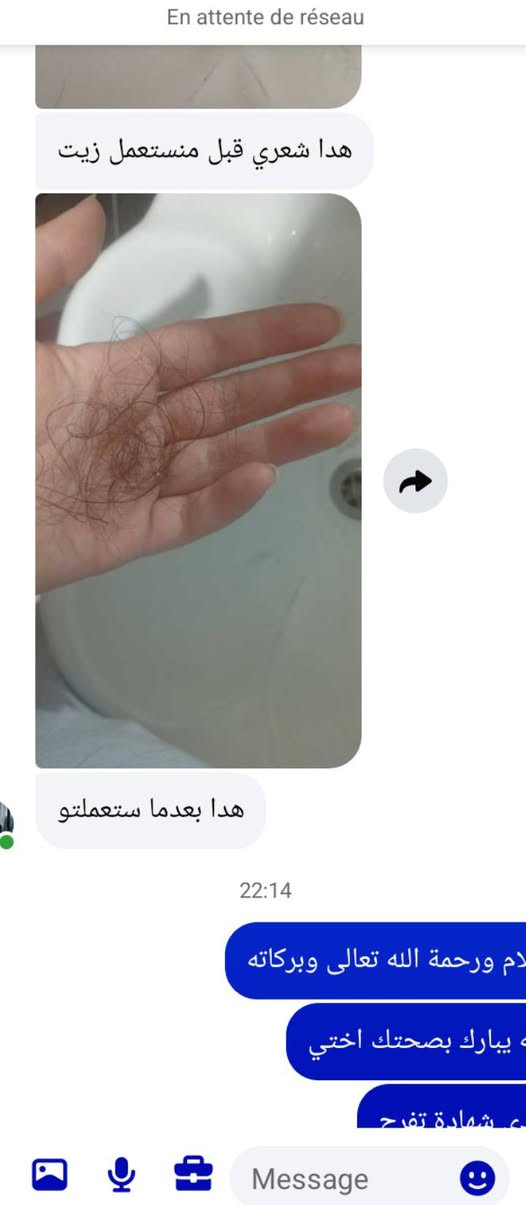 ربي يبارك من الاستعمال الاول شوفو التساقط تاع شعرها كيفاه خف ودرتلو تخفيض نعاون فيكم مع انو والله ثلاااث ماراح تلقاوه بالسعر هادا ويمدلكم نتيجة كما تاعي . مالا يا خويا زيت اختي لي يعاني من اي مشكل فالشعر ماتضيعش وقتك ودراهمك فالحاجة لي ماتستاهلش . مرحبا بيكم اغتنمو الفرصة سمانة نحبس التخفيض.


**إذا كنت صاحب هذا الإعلان وتريد حذفه لأي سبب، رجاءا أرسل رسالة إلى الدعم الفني**