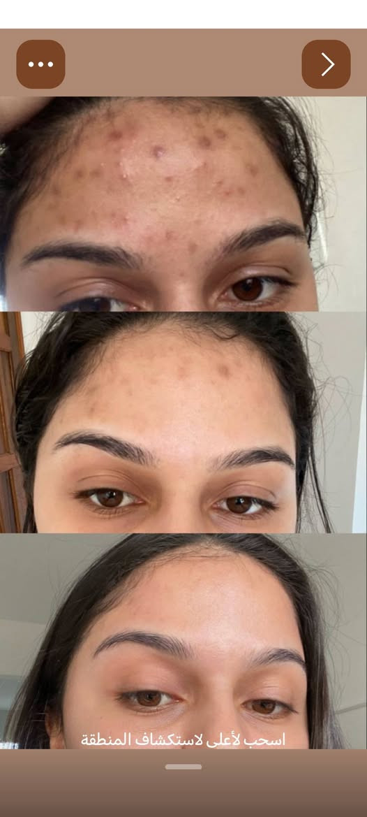 🤩ويا مساء الورد🌷 والمحبه عليكم🥰 زبائنه الحلوين😍 وهل مره اجيناكم🚶‍♀️🚶‍♀️🚶‍♀️ بعروض العيد. 🚶‍♀️🚶‍♀️🚶‍♀️     #عروض العيد  #يمنا وبس ❤️❤️❤️
&عرض ال ٢٥. وهو كااا الآتي يتضمن 
#حفافه وجه  كامل 
#تنضيف بشره عميق🧖‍♀️   # سحب دهون للبشره #تنضيف قدم 
#قص شعر 💇‍♀️💇‍♀️
لكوووووو وتعالو شرفونه🏃‍♀️🏃‍♀️🏃‍♀️🏃‍♀️.  عروضنا. ولا اروع 🏃‍♀️🏃‍♀️
#العرض الثاني. ٥٠ الف العروض يم ليلاس  ما تنتهي العرض كااا الآتي يتضمن 
#حفافه وجه كامل#
#سحب دهون للبشره 

 #تنضيف بشره عميق 
#تنضيف قدم 
 #بدكير  #رموش 
# عروض  قسم الشعر 👩👩👩
#وهو يتضمن كااا الآتي 
#ميش كذله وزلف ١٥ الف فقط 🏃‍♀️🏃‍♀️🏃‍♀️
#ميش كب كامل ٣٠ الف🏃‍♀️🏃‍♀️
##ميش.   تخصيل سلفون  ٢٥ الف 🏃‍♀️
تخصيل سلفون شعر كامل ٤٠.  طويل. +قصر
#لعيون_زبوناتنا_الحلوت
يدللن علينا اميرات٠ النجف 

تغذيه علاج شعر     بس ب ١٥ الف تعالي شمنتضره تعالي 
 ...................................
##عروض قسم تسريح الشعر💆‍♀️💆‍♀️💆‍♀️💆‍♀️💆‍♀️
##عرض التسريح مع معالج مع مغذي للشعر 💆‍♀️💆‍♀️💆‍♀️💆‍♀️💆‍♀️💆‍♀️
#شعر قصير ٣٥الف
# شعر وسط ٤٥الف
#شعر طول طبيعي٥٥الف
#شعر جدا طويل ٦٥الف
#شعر كثيف ٧٥الف
#شعر كثيف جدا جدا ١٠٠الف 
عرض ناري شبه مجاني 💥🏃‍♀️🏃‍♀️🏃‍♀️🏃‍♀️🏃‍♀️🏃‍♀️🏃‍♀️🏃‍♀️🏃‍♀️
#$%%%%*عرض صبغ الشعر عيني سندس الغاليه تعالي يمنه وشوفي الدلال  
### صبغ شعر من الغامق إلى الفاتح الطبيعي 💆‍♀️💆‍♀️💆‍♀️💆‍♀️💆‍♀️#
# صبغ شعر قصير فقط ٢٠ الف
#صبغ شعر وسط فقط ٢٠ الف
#صبغ شعر طويل ٢٥ الف
#صبغ شعر طويل جدا ٤٠ الف. #صبغ شعر طويل كثيف جدا جدا  ٦٥ الف عبالج لهنا ونتهى العرض لا حبي سندس بعده ما خلصت عروضنا 
###صبغ شعر من الفاتح الطبيعي إلى الفاتح جدا جدا حسب اختيارج للون رصاصي فضي بلاتيني اي لون يعجبج نسوي 👩 ودللي علينه..... 
#صبغ شعر قصير ٢٥الف فقط
##صبغ شعر وسط ٣٥ الف فقط
##صبغ شعر طويل  طول طبيعي٤٠الف 
#صبغ شعر طويل جدا جدا ٥٠الف
#صبغ شعر طويل كثيف جدا ٦٥ الف 
 🏃‍♀️ 🏃‍♀️🏃‍♀️🏃‍♀️🏃‍♀️🏃‍♀️🏃‍♀️🏃‍♀️🏃‍♀️#عروض الرموش 
الرموش الطرفيه ١٥الف فقط
رموش الدائميه شهريه ...  ٢٥
شنو منتضره حجزي وتمتعي بحواجب طبيعية  جميع انواع #التاتو. ٢٥ الف فقط
بكادر  بروفيشنال اختصاص تاتو 💪
ليش نختار ليلاس🤔
لان  ليلاس  مملكة التاتو
لان شغل معجزة ودقة بالقياسات وعرض شبه مجاني 😍
_لان أحبار أمريكية وكادر  بروفيشنال حاصل على شهادة أكاديمية فايبروز العالمية 💪
🏃‍♀️🏃‍♀️🏃‍♀️🏃‍♀️🏃‍♀️🏃‍♀️🏃‍♀️🏃‍♀️🏃‍♀️🏃‍♀️🏃‍♀️🏃‍♀️🏃‍♀️🏃‍♀️🏃‍♀️🏃‍♀️
جميع انواع #التاتو ٢٥ الف الجلسة
&&& توريد الشفة👄👄 ٢٥ الف العروض بس ب ٢٥الف  🫠🫠 وين اكو هيج    🏃‍♀️ 🏃‍♀️ 🏃‍♀️ 🏃‍♀️ جميع انواع #التاتو فقط ٢٥ الف فقط 

للحجز والاستفسار مراسلة الصفحة  
***********3
https://wa.me/9647751914743
النجف الاشرف  حي النصر طريق الجنه  عامود ٦٦
